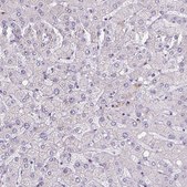 Anti-YAP1 Prestige Antibodies® Powered by Atlas Antibodies, affinity isolated antibody