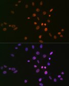 Anti-SMC1 antibody produced in rabbit