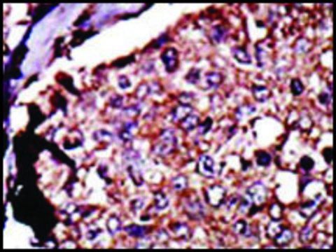 Anti-DGKB (C-term) antibody produced in rabbit IgG fraction of antiserum, buffered aqueous solution