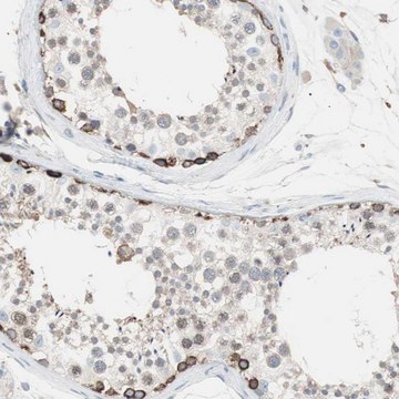 Anti-SLC27A4 antibody produced in rabbit Prestige Antibodies&#174; Powered by Atlas Antibodies, affinity isolated antibody, buffered aqueous glycerol solution