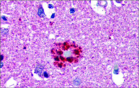 Anti-TCF21 antibody produced in rabbit affinity isolated antibody