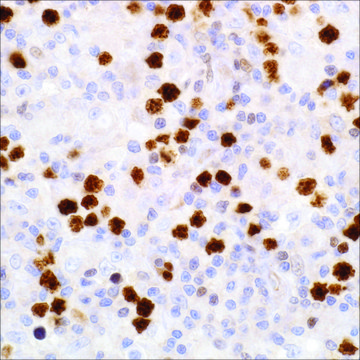 FoxP1 (SP133) Rabbit Monoclonal Antibody