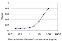 Monoclonal Anti-TRIM37 antibody produced in mouse clone 2D11, purified immunoglobulin, buffered aqueous solution