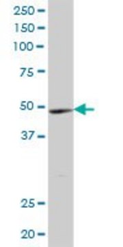 Anti-YTHDF2 antibody produced in mouse IgG fraction of antiserum, buffered aqueous solution