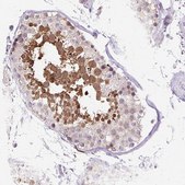 Anti-HSPA1A antibody produced in rabbit Prestige Antibodies® Powered by Atlas Antibodies, affinity isolated antibody, buffered aqueous glycerol solution