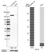 Anti-STK10 antibody produced in rabbit Prestige Antibodies® Powered by Atlas Antibodies, affinity isolated antibody, buffered aqueous glycerol solution