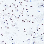 Anti-Symmetric DiMethyl-Histone H3-R2 antibody produced in rabbit