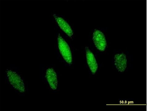 Anti-GSTO1 antibody produced in mouse purified immunoglobulin, buffered aqueous solution