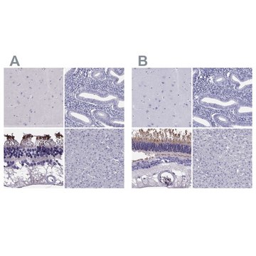 Anti-PDE6A antibody produced in rabbit Prestige Antibodies&#174; Powered by Atlas Antibodies, affinity isolated antibody