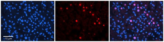 Anti-RAD54B (ab3) antibody produced in rabbit affinity isolated antibody