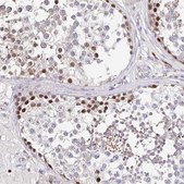 Anti-TIMELESS antibody produced in rabbit Prestige Antibodies® Powered by Atlas Antibodies, affinity isolated antibody, buffered aqueous glycerol solution