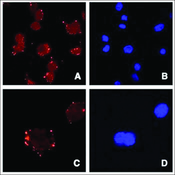 Anti-ASPORIN/ASPN antibody produced in goat affinity isolated antibody, buffered aqueous solution