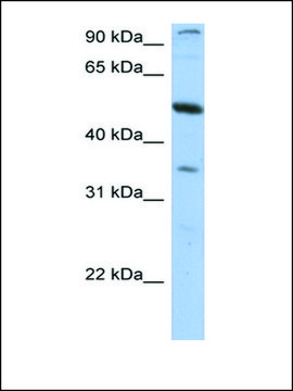 Anti-PLXDC1 antibody produced in rabbit affinity isolated antibody