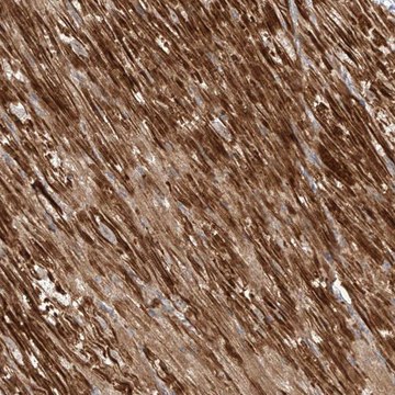 Anti-OCSTAMP antibody produced in rabbit Prestige Antibodies&#174; Powered by Atlas Antibodies, affinity isolated antibody, buffered aqueous glycerol solution