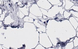 Anti-Perilipin-1 Antibody, clone 1G23 ZooMAb® Rabbit Monoclonal recombinant, expressed in HEK 293 cells