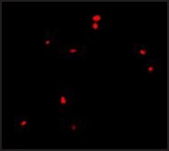 Anti-CIDE-B (ab2) antibody produced in rabbit affinity isolated antibody, buffered aqueous solution