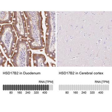 Anti-HSD17B2 antibody produced in rabbit Prestige Antibodies&#174; Powered by Atlas Antibodies, affinity isolated antibody, buffered aqueous glycerol solution