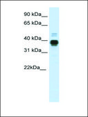 Anti-HOXA11 antibody produced in rabbit affinity isolated antibody