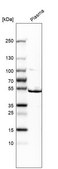 Anti-ST3GAL1 antibody produced in rabbit Prestige Antibodies® Powered by Atlas Antibodies, affinity isolated antibody, buffered aqueous glycerol solution