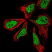 Anti-NPAS3 antibody produced in rabbit Prestige Antibodies® Powered by Atlas Antibodies, affinity isolated antibody, buffered aqueous glycerol solution