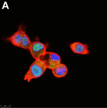 Anti-SNAI1 Antibody, clone 1F16 ZooMAb&#174; Rabbit Monoclonal recombinant, expressed in HEK 293 cells