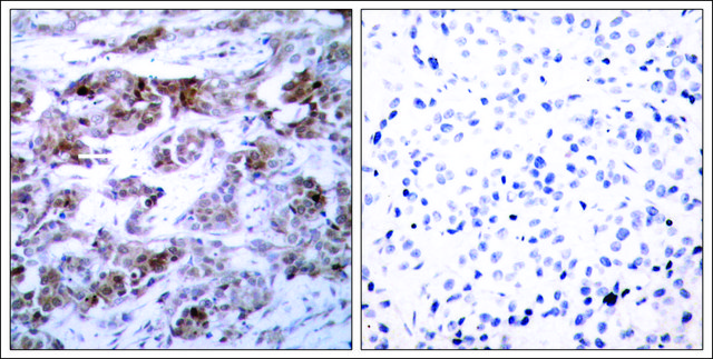 Anti-BCL2 (Ab-70) antibody produced in rabbit affinity isolated antibody