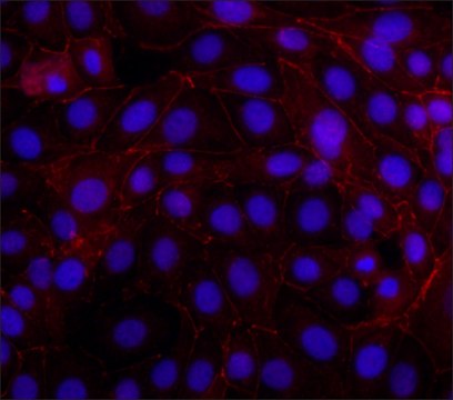 Anti-&#946;-Catenin&#8722;Cy3 antibody, Mouse monoclonal clone 15B8, purified from hybridoma cell culture