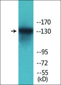 Anti-phospho-HDAC6 (pSer22) antibody produced in rabbit affinity isolated antibody