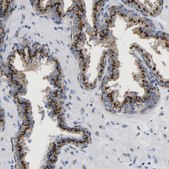 Anti-TMEM87A antibody produced in rabbit Prestige Antibodies® Powered by Atlas Antibodies, affinity isolated antibody, buffered aqueous glycerol solution