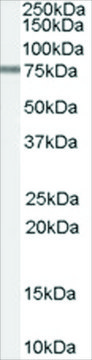 Anti-PDE4D3 antibody produced in goat affinity isolated antibody, buffered aqueous solution