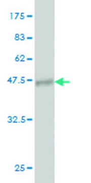 Monoclonal Anti-PIP5K1C antibody produced in mouse clone 7D11, purified immunoglobulin, buffered aqueous solution