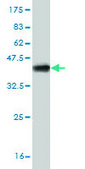 Monoclonal Anti-LIAS antibody produced in mouse clone 1C7, purified immunoglobulin, buffered aqueous solution