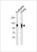 [KO Validated]Anti-LAMP2 antibody produced in rabbit [Knockout Validated],purified polyclonal antibody, buffered aqueous solution