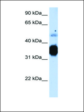 Anti-TNNT3 antibody produced in rabbit IgG fraction of antiserum