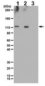 Anti-phospho-NF-kB (p100) (Ser707) Antibody from rabbit, purified by affinity chromatography