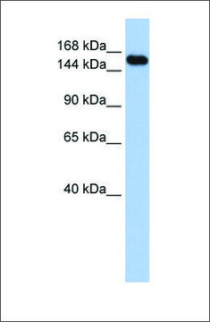 Anti-UBE3A (ab1) antibody produced in rabbit affinity isolated antibody