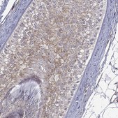 Anti-GJB4 antibody produced in rabbit Prestige Antibodies® Powered by Atlas Antibodies, affinity isolated antibody, buffered aqueous glycerol solution