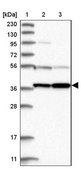 Anti-PRUNE2 antibody produced in rabbit Prestige Antibodies® Powered by Atlas Antibodies, affinity isolated antibody, buffered aqueous glycerol solution