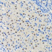 Anti-PIM1 antibody produced in rabbit