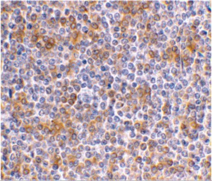 Anti-APOBEC3G antibody produced in rabbit affinity isolated antibody