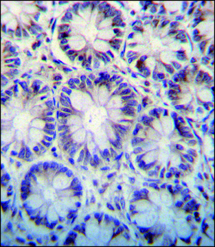 ANTI-MOUSE PARP9 (N-TERM) antibody produced in rabbit IgG fraction of antiserum, buffered aqueous solution