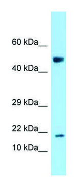 Anti-Ankrd37 (N-terminal) antibody produced in rabbit affinity isolated antibody