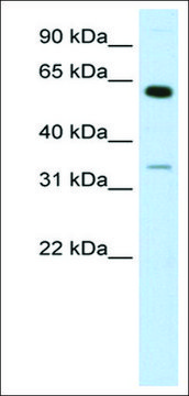 Anti-ZNF609 antibody produced in rabbit IgG fraction of antiserum