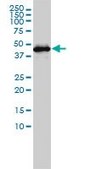 Monoclonal Anti-GSDMDC1 antibody produced in mouse clone 3F12-1B2, purified immunoglobulin, buffered aqueous solution