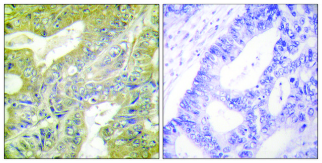 Anti-HEXB antibody produced in rabbit affinity isolated antibody