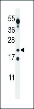 ANTI-CT45A (CENTER) antibody produced in rabbit IgG fraction of antiserum, buffered aqueous solution