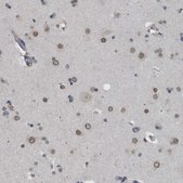 Anti-NUP93 antibody produced in rabbit Prestige Antibodies® Powered by Atlas Antibodies, affinity isolated antibody, buffered aqueous glycerol solution