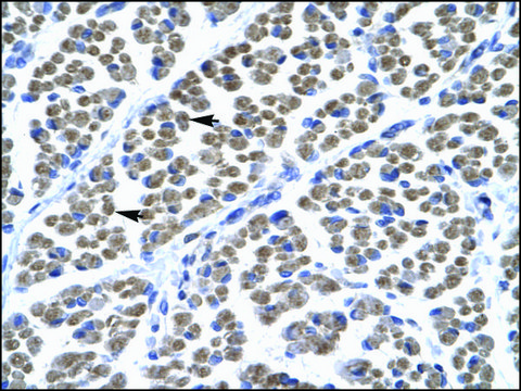 Anti-TBX5 (AB1) antibody produced in rabbit affinity isolated antibody