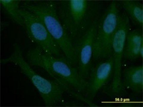 Monoclonal Anti-SNAI2 antibody produced in mouse clone 3C12, purified immunoglobulin, buffered aqueous solution