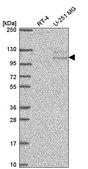 Anti-TSR1 antibody produced in rabbit Prestige Antibodies® Powered by Atlas Antibodies, affinity isolated antibody